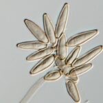 Asteromyces Condidia - Click to zoom.