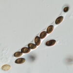 Sordaria Ascus with Ascospores - Click to zoom.